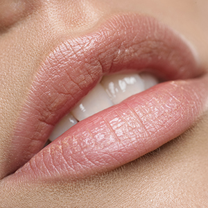 A Permanent Lip Plumper - Cupid's Bow Surgery - AHB